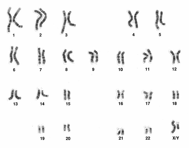 chromosomen_wikipedia_pd